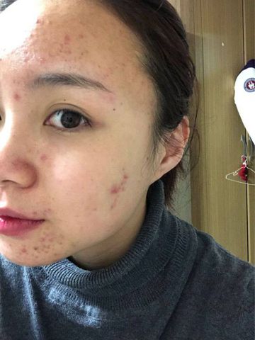 … – Giản đơn